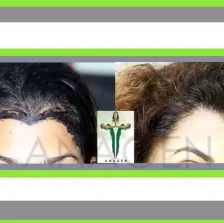 eyebrow-2